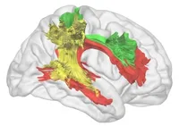 Functional White Matter Atlas of Language